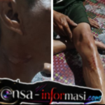 Akibat Kabel WIFI Menjuntai ke Jalan, Pengendara Sepeda Motor Jadi Korban: Desak Dinas Terkait Tetapkan Sanksi Tegas Berdasarkan Peraturan Perundang-Undangan