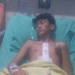 Pascaoperasi, Korban Penusukan Remaja di Karang Anyar Gandus Fokus Pemulihan